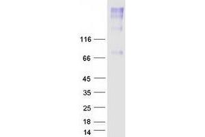 Validation with Western Blot