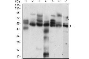 Fig. (Cyclin E1 anticorps  (AA 307-410))