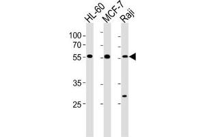 Western Blotting (WB) image for anti-Chromosome 16 Open Reading Frame 71 (C16ORF71) antibody (ABIN3004592) (C16ORF71 anticorps)