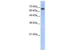 WB Suggested Anti-ARHGAP28 Antibody Titration: 0. (ARHGAP28 anticorps  (N-Term))
