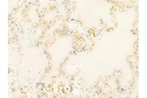 ABIN6263246 and ABIN6274024 at 1/100 staining human normal lung tissue by IHC-P. (MICA anticorps  (C-Term))
