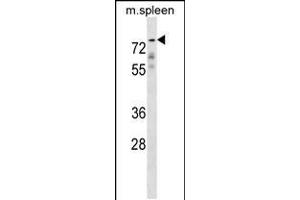 Western blot analysis in mouse spleen tissue lysates (35ug/lane).