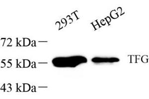 Western blot analysis of TFG (ABIN7076022),at dilution of 1: 1000 (TFG anticorps)