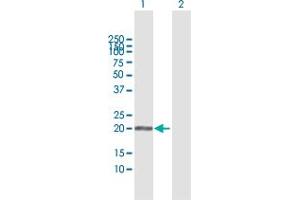 Western Blot analysis of APRT expression in transfected 293T cell line by APRT MaxPab polyclonal antibody.