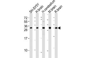 All lanes : Anti-FGF14 Antibody (C-term) at 1:2000 dilution Lane 1: SH-SY5Y whole cell lysates Lane 2: human brain lysates Lane 3: human cerebellum lysates Lane 4: mouse brain lysates Lane 5: rat brain lysates Lysates/proteins at 20 μg per lane. (FGF14 anticorps  (C-Term))