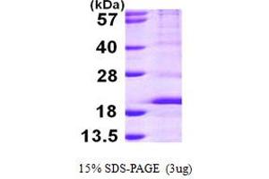 SDS-PAGE (SDS) image for Ribosomal Protein S14 (RPS14) (AA 1-151) protein (His tag) (ABIN7279332)