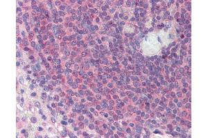 Anti-TGFB1I1 / HIC-5 antibody IHC of human spleen.