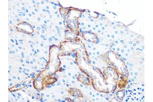 Immunohistochemistry of paraffin-embedded Mouse kidney using YTHDF2 antibody (ABIN7271427) at dilution of 1:100 (40x lens).
