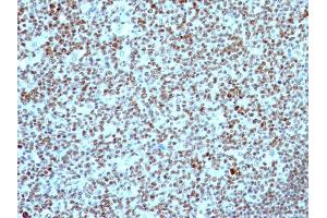 Formalin-fixed, paraffin-embedded human Tonsil stained with Nucleolin Mouse Monoclonal Antibody (NCL/902).