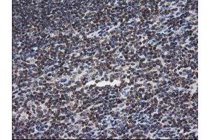 Image no. 2 for anti-Nonhomologous End-Joining Factor 1 (NHEJ1) antibody (ABIN1499728)