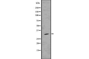 Western blot analysis of prouty 4 using K562 whole cell lysates (SPRY4 anticorps  (Internal Region))
