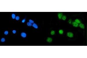 IF analysis of LSM7 using anti-LSM7 antibody (ABIN7598937). (LSM7 anticorps  (AA 1-103))