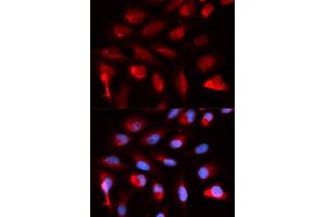 Immunofluorescence analysis of U2OS cells using PPARD antibody (ABIN5973301). (PPARD anticorps)