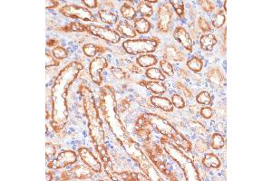 Immunohistochemistry of paraffin-embedded rat kidney using CYB5A antibody (ABIN6130832, ABIN6139296, ABIN6139297 and ABIN6221049) at dilution of 1:100 (40x lens). (CYB5A anticorps  (AA 1-100))