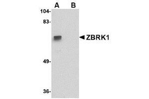 Image no. 1 for anti-Zinc Finger Protein 350 (ZNF350) (C-Term) antibody (ABIN342727) (ZNF350 anticorps  (C-Term))