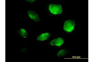 Immunofluorescence of purified MaxPab antibody to TXNDC5 on HeLa cell. (TXNDC5 anticorps  (AA 1-360))