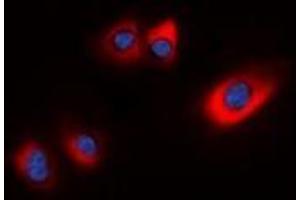 Immunofluorescent analysis of HSP20 (pS16) staining in HEK293T cells.