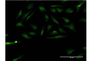 Immunofluorescence of monoclonal antibody to RPS6KA1 on HeLa cell. (RPS6KA1 anticorps  (AA 1-735))