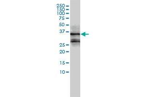 FOSL2 monoclonal antibody (M01), clone 2B4-1C2 Western Blot analysis of FOSL2 expression in MCF-7 .