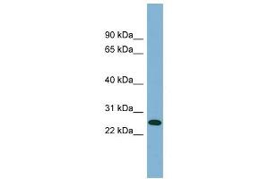 ITGB1BP3 antibody used at 1 ug/ml to detect target protein. (ITGB1BP3 anticorps  (Middle Region))