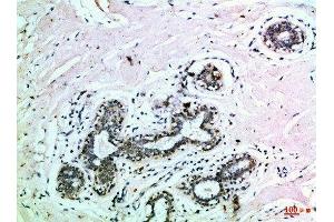 Immunohistochemical analysis of paraffin-embedded Human-breast, antibody was diluted at 1:100