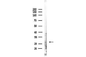 anti-Granzyme K (Granzyme 3, Tryptase II) (GZMK) (Internal Region) antibody