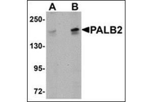 Western blot analysis of PALB2 in SK-N-SH cell lysate with this product at (A) 1 and (B) 2 μg/ml.