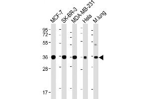 All lanes : Anti-WNT4 Antibody at 1:4000 dilution Lane 1: MCF-7 whole cell lysate Lane 2: SK-BR-3 whole cell lysate Lane 3: MDA-MB-231 whole cell lysate Lane 4: Hela whole cell lysate Lane 5: Mouse lung lysate Lysates/proteins at 20 μg per lane.