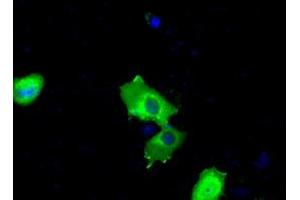 Image no. 7 for anti-Bruton Agammaglobulinemia tyrosine Kinase (BTK) antibody (ABIN1496976) (BTK anticorps)