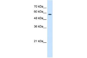 WB Suggested Anti-CCT8 Antibody Titration:  0. (CCT8 anticorps  (C-Term))