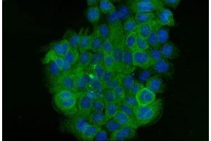 IF analysis of Cytokeratin 5 using anti-Cytokeratin 5 antibody (ABIN7602992). (Cytokeratin 5 anticorps  (Middle Region))