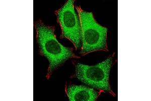 Fluorescent image of MCF-7 cells stained with GLD2 Antibody (N-term) (ABIN651284 and ABIN2840170). (PAPD4 anticorps  (N-Term))