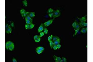 Immunofluorescent analysis of PC-3 cells using ABIN7174771 at dilution of 1:100 and Alexa Fluor 488-congugated AffiniPure Goat Anti-Rabbit IgG(H+L) (C19orf48 anticorps  (AA 1-117))