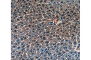 IHC-P analysis of liver tissue, with DAB staining. (CASP14 anticorps  (AA 1-257))
