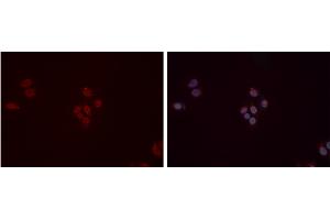 ABIN6277358 staining Hela cells by IF/ICC.