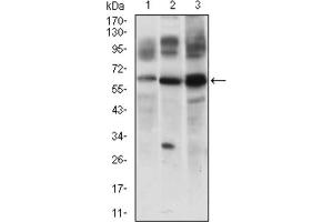 Western blot analysis using CFLAR antibody against JURKAT (1), 3T3L1 (2) and RAJI (3) cell lysate. (FLIP anticorps  (AA 100-251))