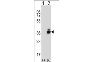 anti-Corticotropin Releasing Hormone Binding Protein (CRHBP) (AA 7-36), (N-Term) antibody