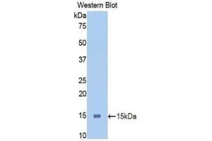 Western blot analysis of the recombinant protein. (PIGR anticorps  (AA 463-563))
