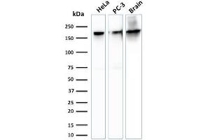 Western Blot Analysis of HeLa, PC-3 cells and brain tissue lysate using Spectrin beta III Mouse Monoclonal Antibody (SPTBN2/1778).