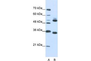 WB Suggested Anti-WDR6 Antibody Titration:  0. (WDR6 anticorps  (C-Term))