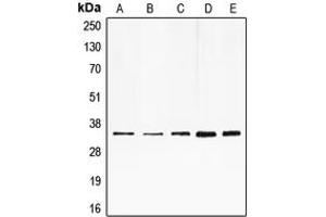 Western blot analysis of E2F6 expression in HeLa (A), HepG2 (B), K562 (C), mouse muscle (D), rat heart (E) whole cell lysates.