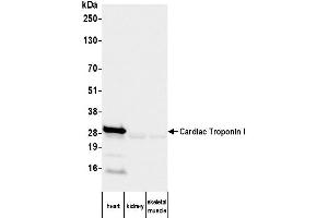 Western Blotting (WB) image for anti-Cardiac Troponin I (TNNI3) antibody (ABIN7795611) (TNNI3 anticorps)