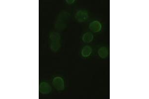 Anti-HHex mouse monoclonal antibody (ABIN2452343) immunofluorescent staining of HeLa cells transiently transfected by pCMV6-ENTRY HHex (RC204815) (HHEX anticorps  (AA 100-270))