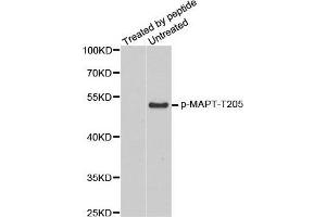 Western Blotting (WB) image for anti-Microtubule-Associated Protein tau (MAPT) (pThr205) antibody (ABIN3019698)