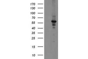 Western Blotting (WB) image for anti-Diphthamide Biosynthesis Protein 2 (DPH2) antibody (ABIN1497894) (DPH2 anticorps)