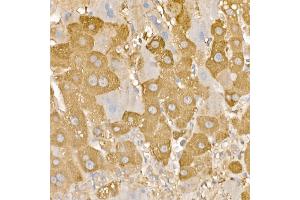Immunohistochemistry of paraffin-embedded human liver using [KO Validated] RA Rabbit pAb (ABIN3021646, ABIN3021647, ABIN3021648 and ABIN1513457) at dilution of 1:100 (40x lens). (RAB5 anticorps  (AA 1-215))