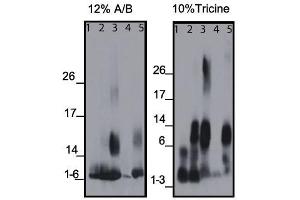 Western blots of the monoclonal antibody binding to different amyloid beta (Abeta) regions of human and mouse protein, using 12% A/B (acrylamide/bisacrylamide) or 10% Tricine matrix. (beta Amyloid anticorps  (C-Term))
