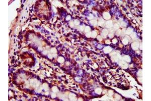 IHC image of ABIN7153467 diluted at 1:300 and staining in paraffin-embedded human small intestine tissue performed on a Leica BondTM system.