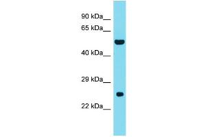 Host: Rabbit Target Name: DNAAF3 Sample Type: Fetal Liver lysates Antibody Dilution: 1. (DNAAF3 anticorps  (C-Term))