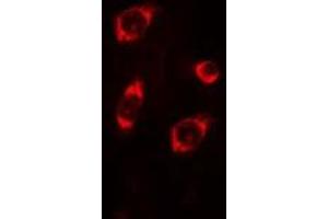 ABIN6275244 staining COLO205 cells by IF/ICC. (MRPL4 anticorps  (Internal Region))